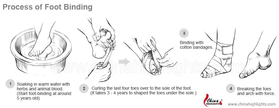 Chinese foot binding