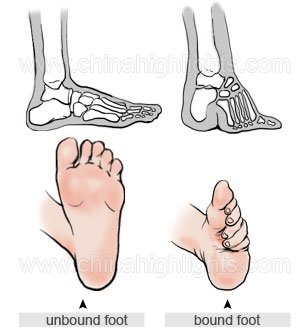 chinese foot binding
