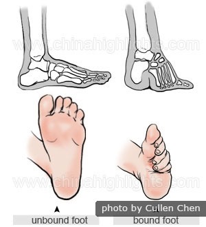 Foot Binding in China